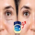 PurePlus Hygienic Vaseline – 60/80/120g Skin Protectant for Dry & Sensitive Skin